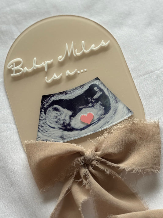 Baby shower card with ultrasound photo and bow on a white background