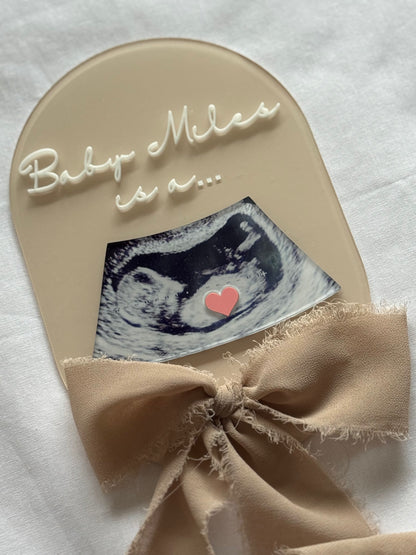 Baby shower card with ultrasound photo and bow on a white background