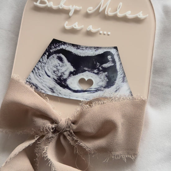 Sonogram video