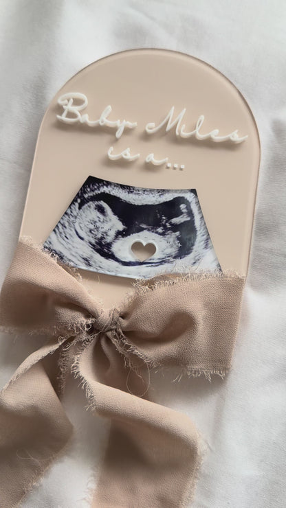 Sonogram video